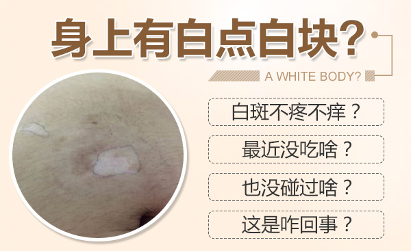 合肥華研白癜風醫(yī)院